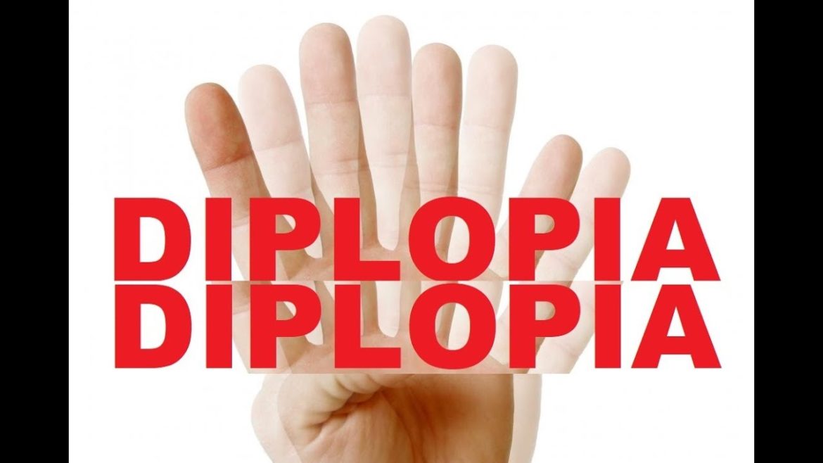 Diplopia: cos’è e come riconoscerla